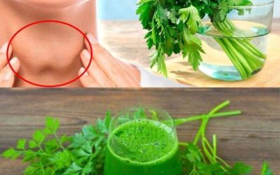 6 prostych kroków do naturalnego wyleczenia tarczycy za pomocą pietruszki i innych produktów