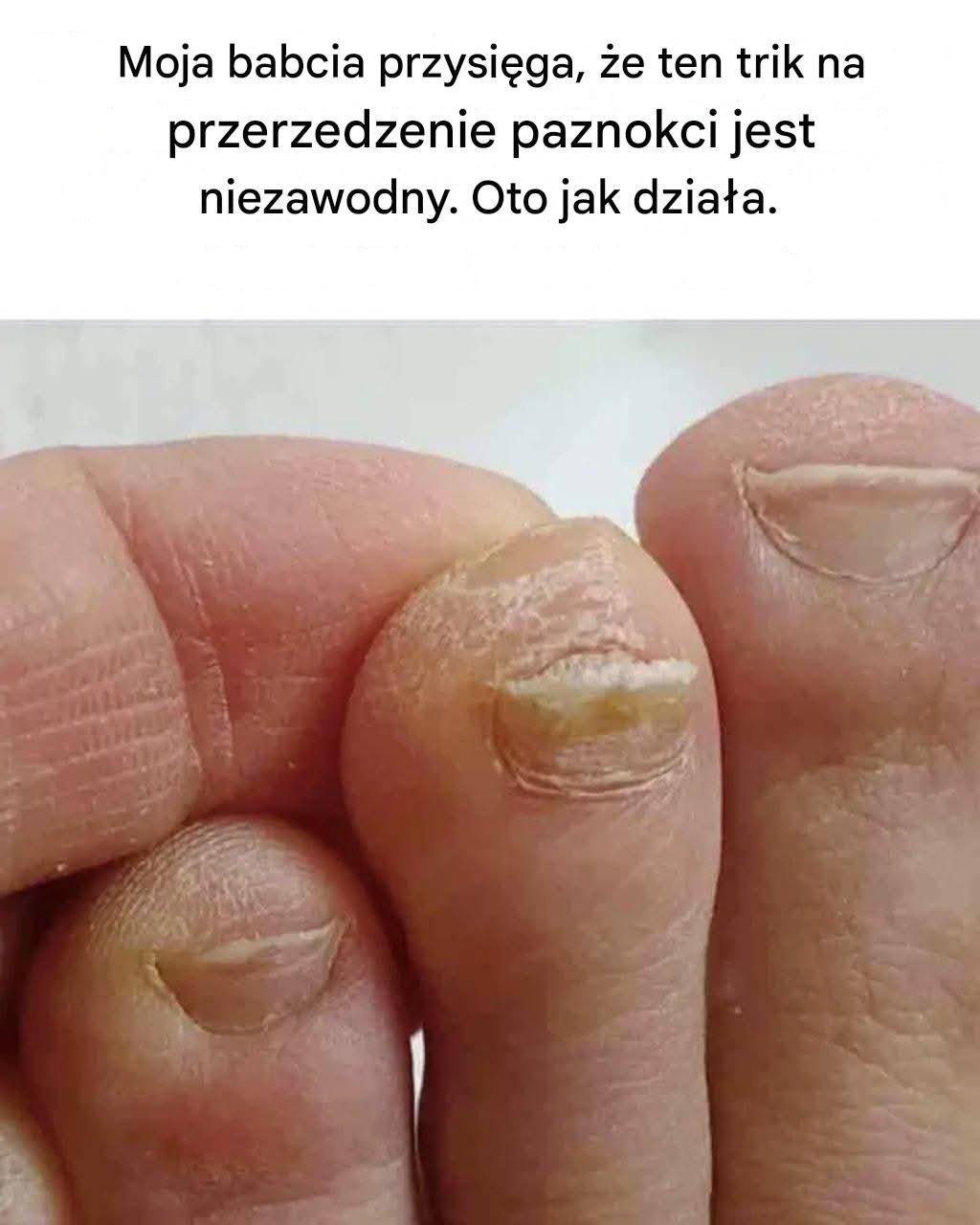 Moja babcia przysięga, że ​​ten trik na przerzedzenie paznokci jest niezawodny. Oto jak działa.